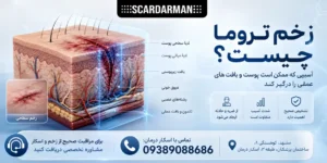 زخم تروما چیست؟